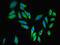 Poly [ADP-ribose] polymerase 3 antibody, LS-C376271, Lifespan Biosciences, Immunofluorescence image 