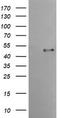 Transmembrane Serine Protease 5 antibody, TA504339S, Origene, Western Blot image 