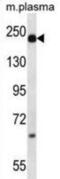 Alpha-2-Macroglobulin antibody, abx028308, Abbexa, Western Blot image 