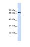 Ubiquilin 1 antibody, NBP1-56536, Novus Biologicals, Western Blot image 