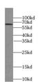 Solute Carrier Family 30 Member 7 antibody, FNab09749, FineTest, Western Blot image 