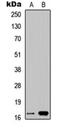 Cathepsin F antibody, orb234787, Biorbyt, Western Blot image 