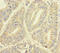 YME1 Like 1 ATPase antibody, LS-C676722, Lifespan Biosciences, Immunohistochemistry paraffin image 