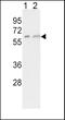 Cytochrome P450 Family 7 Subfamily A Member 1 antibody, 63-325, ProSci, Western Blot image 