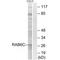 RAB6C, Member RAS Oncogene Family antibody, A10238, Boster Biological Technology, Western Blot image 