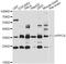 Phosphopantothenoylcysteine Synthetase antibody, LS-C747911, Lifespan Biosciences, Western Blot image 