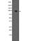 Endoglin antibody, abx215162, Abbexa, Western Blot image 
