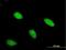 Aristaless Related Homeobox antibody, H00170302-M03, Novus Biologicals, Immunocytochemistry image 