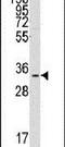 Complement C1q Binding Protein antibody, PA5-14989, Invitrogen Antibodies, Western Blot image 