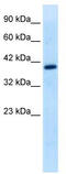 Transcription factor EB antibody, TA330079, Origene, Western Blot image 