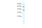 Minichromosome Maintenance Complex Component 7 antibody, 28-540, ProSci, Western Blot image 