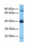 Squalene monooxygenase antibody, GTX47082, GeneTex, Western Blot image 