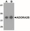 Adenosine A2b Receptor antibody, NBP2-41312, Novus Biologicals, Western Blot image 