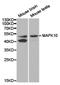 Mitogen-Activated Protein Kinase 10 antibody, LS-C192875, Lifespan Biosciences, Western Blot image 