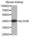 Aldolase, Fructose-Bisphosphate B antibody, abx002683, Abbexa, Western Blot image 