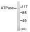 ATPase Na+/K+ Transporting Subunit Alpha 1 antibody, EKC1928, Boster Biological Technology, Western Blot image 
