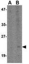 Bone Marrow Stromal Cell Antigen 2 antibody, GTX31346, GeneTex, Western Blot image 