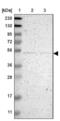 Neuropilin And Tolloid Like 2 antibody, NBP1-84624, Novus Biologicals, Western Blot image 