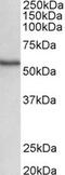 Serine/threonine-protein kinase 38 antibody, MBS422828, MyBioSource, Western Blot image 