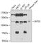 Integrator Complex Subunit 5 antibody, GTX33270, GeneTex, Western Blot image 