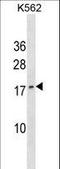  antibody, LS-C159717, Lifespan Biosciences, Western Blot image 