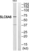 Solute Carrier Family 6 Member 6 antibody, abx014892, Abbexa, Immunohistochemistry frozen image 