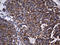 Starch Binding Domain 1 antibody, LS-C799168, Lifespan Biosciences, Immunohistochemistry paraffin image 