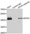 Eukaryotic Translation Initiation Factor 3 Subunit H antibody, LS-C346190, Lifespan Biosciences, Immunoprecipitation image 