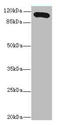 TSP3 antibody, A57777-100, Epigentek, Western Blot image 