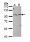 TBC1 Domain Containing Kinase antibody, LS-C186227, Lifespan Biosciences, Western Blot image 