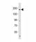 ALK Receptor Tyrosine Kinase antibody, F53252-0.4ML, NSJ Bioreagents, Western Blot image 