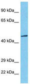 T-Box 20 antibody, TA331828, Origene, Western Blot image 