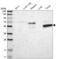 KH Domain Containing 4, Pre-MRNA Splicing Factor antibody, NBP1-86485, Novus Biologicals, Western Blot image 