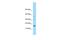 H2A Histone Family Member J antibody, A14943, Boster Biological Technology, Western Blot image 