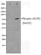 Arachidonate 5-Lipoxygenase antibody, LS-C415793, Lifespan Biosciences, Western Blot image 