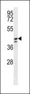 Dihydrouridine Synthase 1 Like antibody, LS-C167563, Lifespan Biosciences, Western Blot image 