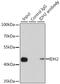 Isocitrate Dehydrogenase (NADP(+)) 2, Mitochondrial antibody, 22-769, ProSci, Immunoprecipitation image 