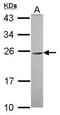 Carcinoembryonic Antigen Related Cell Adhesion Molecule 3 antibody, GTX112781, GeneTex, Western Blot image 