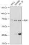 Polo Like Kinase 1 antibody, GTX54548, GeneTex, Western Blot image 