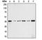 Aldolase, Fructose-Bisphosphate A antibody, orb213551, Biorbyt, Western Blot image 