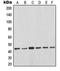 MCL1 Apoptosis Regulator, BCL2 Family Member antibody, orb214233, Biorbyt, Western Blot image 