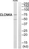 Chloride Voltage-Gated Channel Ka antibody, PA5-39102, Invitrogen Antibodies, Western Blot image 