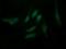Gamma-Butyrobetaine Hydroxylase 1 antibody, NBP2-45548, Novus Biologicals, Immunofluorescence image 