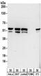 Tryptophanyl-TRNA Synthetase antibody, NBP2-32186, Novus Biologicals, Western Blot image 