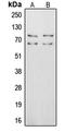 Vitronectin antibody, LS-C353010, Lifespan Biosciences, Western Blot image 