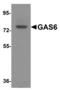 Growth Arrest Specific 6 antibody, LS-B13094, Lifespan Biosciences, Western Blot image 