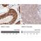 NIMA Related Kinase 3 antibody, NBP2-13650, Novus Biologicals, Immunohistochemistry paraffin image 