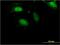 Zinc Finger Protein 598 antibody, MA5-22840, Invitrogen Antibodies, Immunofluorescence image 