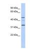 Cyclin Y Like 1 antibody, NBP1-70490, Novus Biologicals, Western Blot image 