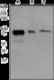 Estrogen Receptor 1 antibody, ab108398, Abcam, Western Blot image 